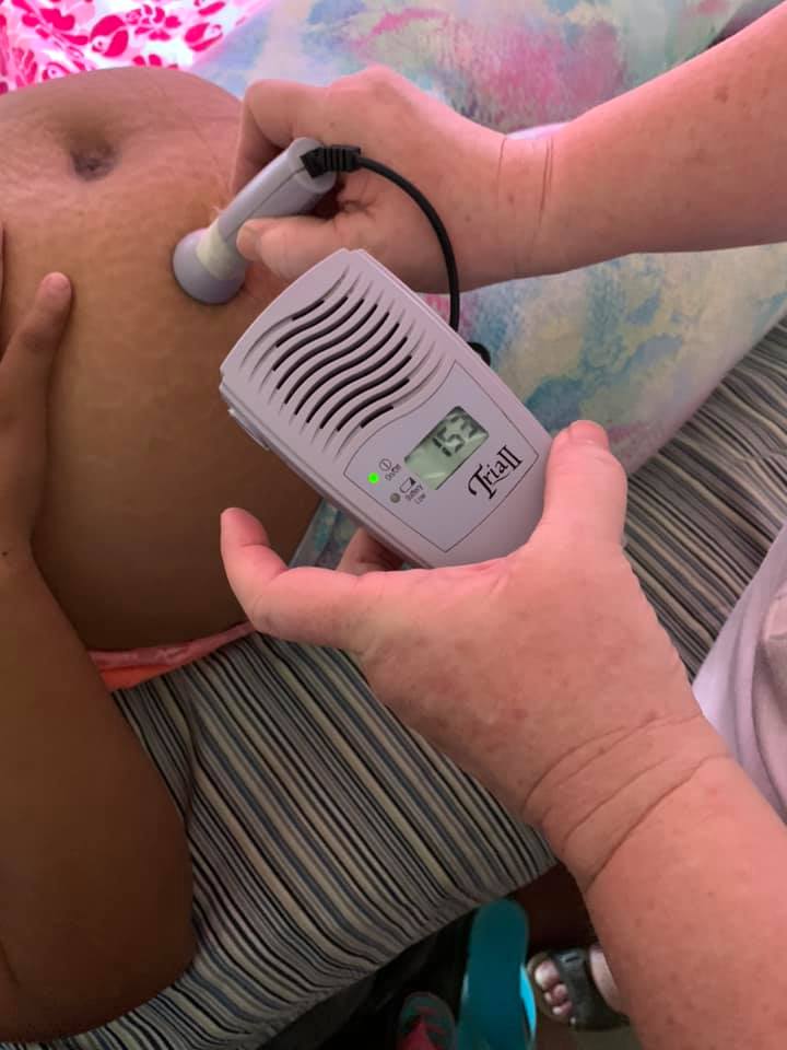 Fetal Doppler Check